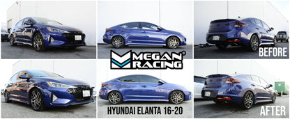 Megan Racing Street-Version Coilover Spring Lowering Kit For 17-20 Hyundai Elantra Sport w/Multi-Link (AD 6th Gen)